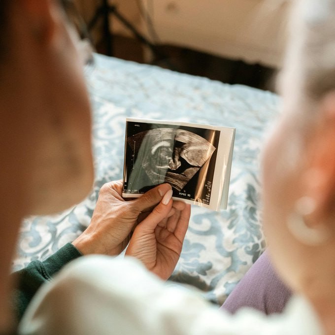 TÜİK verilerine göre bu yılın 7 ayında 503 bin doğum gerçekleşti.   Geçen yıla göre bu oran %8.3 düştü.